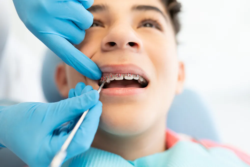 Latin,Teenage,Boy,With,Dentist,Adjusting,New,Elastic,Bands,On